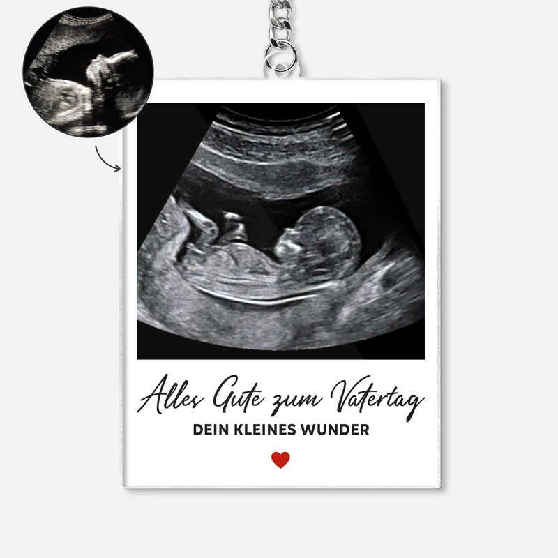 Vatertag Muttertag - Personalisiertes Geschenk | Acryl Schlüsselanhänger Ultraschallfoto Baby