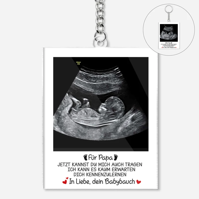 Ultraschallbild Baby - Personalisierte Geschenke Foto | Acryl Schlüsselanhänger