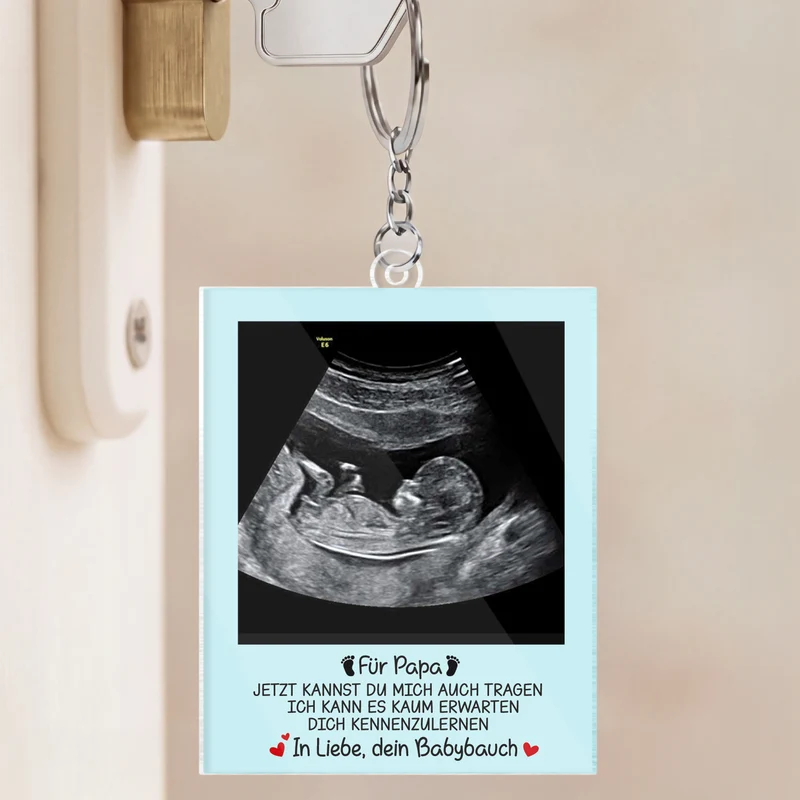 Ultraschallbild Baby - Personalisierte Geschenke Foto | Acryl Schlüsselanhänger