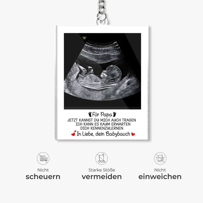 Ultraschallbild Baby - Personalisierte Geschenke Foto | Acryl Schlüsselanhänger